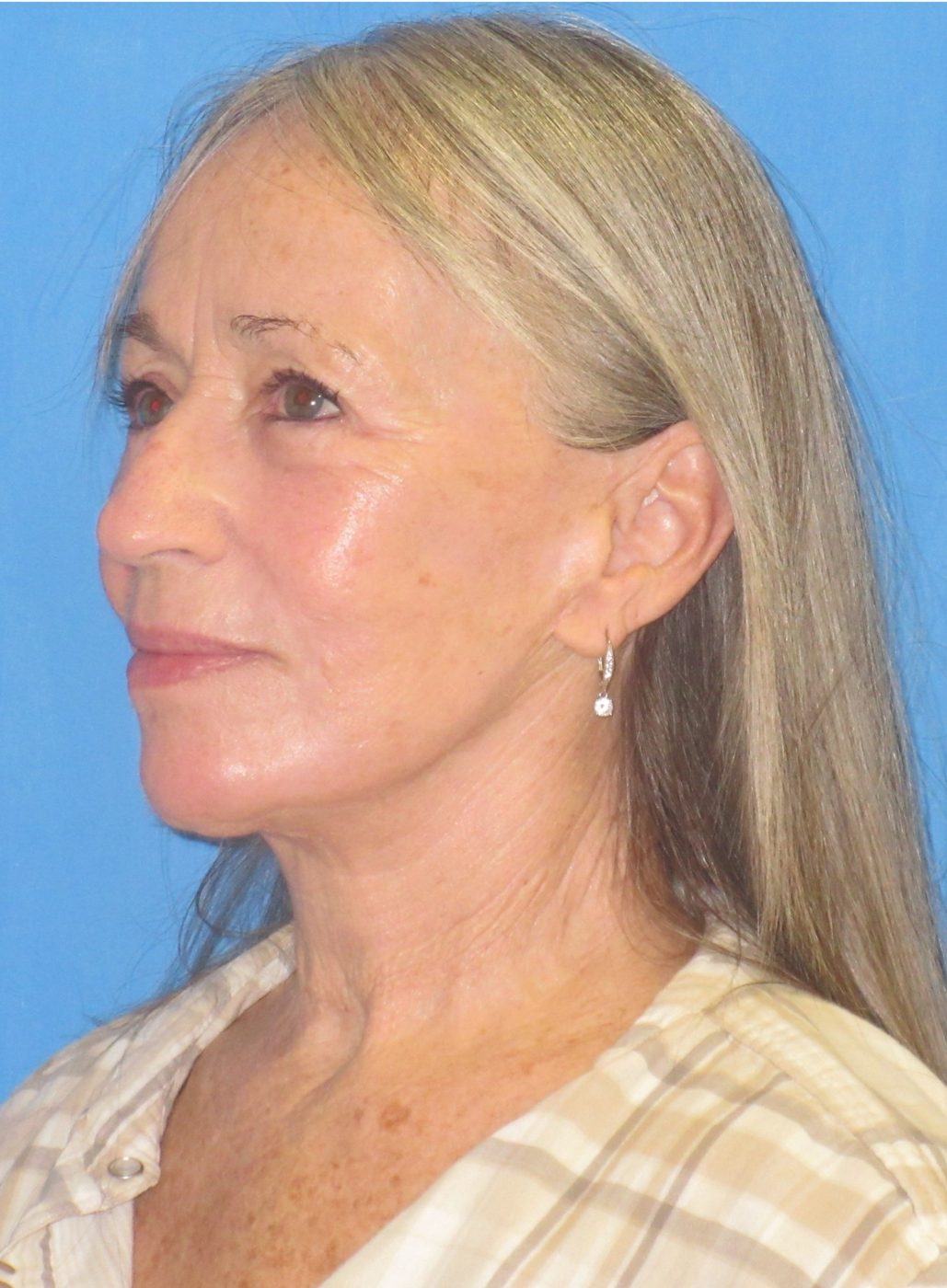 Reconstructive & Laser Therapy after