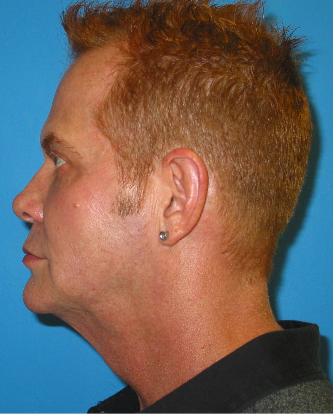 Prendiville Signature Lift before