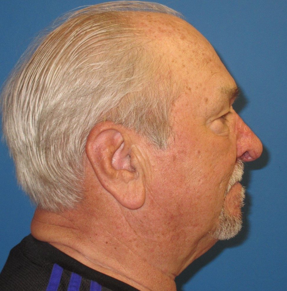 Reconstructive & Laser Therapy after