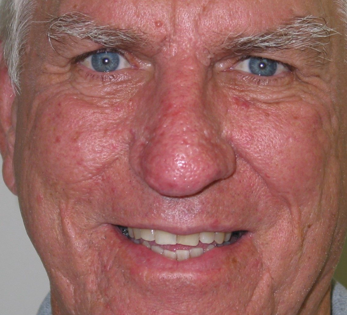 Reconstructive & Laser Therapy after
